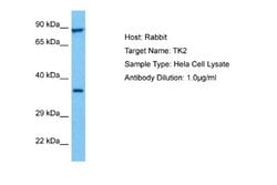 Thymidine Kinase 2 Rabbit anti-Human, Polyclonal, Novus Biologicals 0.1ml;